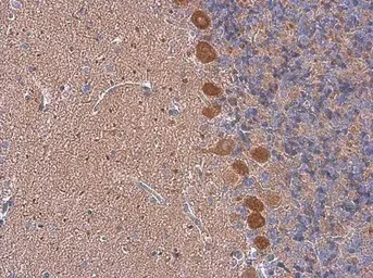 Immunohistochemistry (Formalin/PFA-fixed paraffin-embedded sections) - Anti-BCAR1 antibody (AB137507)