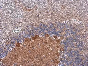 Immunohistochemistry (Formalin/PFA-fixed paraffin-embedded sections) - Anti-BCAR1 antibody (AB137507)