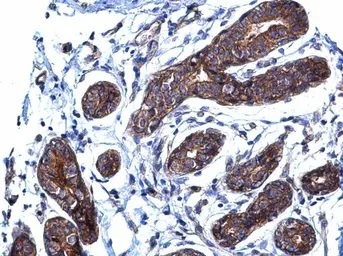 Immunohistochemistry (Formalin/PFA-fixed paraffin-embedded sections) - Anti-BCAR1 antibody (AB137507)