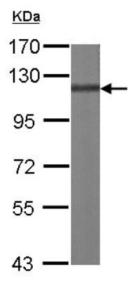 Western blot - Anti-BCAR1 antibody (AB137507), expandable thumbnail