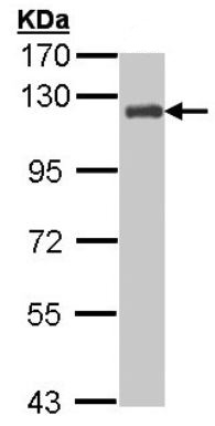 Western blot - Anti-BCAR1 antibody (AB137507), expandable thumbnail