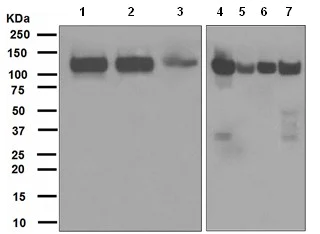 Western blot - Anti-BCAR1 antibody [EPR1850(2)] - BSA and Azide free (AB247628)