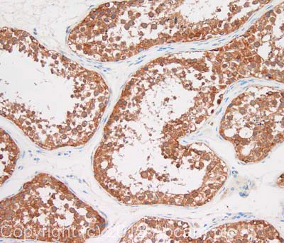 Immunohistochemistry (Formalin/PFA-fixed paraffin-embedded sections) - Anti-BCAR1 antibody [M144] (AB31831)