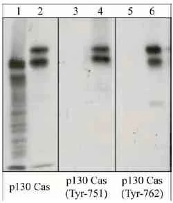 Western blot - Anti-BCAR1 antibody [M144] (AB31831)