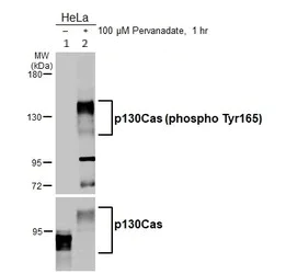 Western blot - Anti-BCAR1 (phospho Y165) antibody - N-terminal (AB226914)