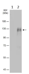 Western blot - Anti-BCAR1 (phospho Y165) antibody - N-terminal (AB226914)