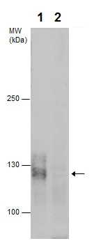 Western blot - Anti-BCAR1 (phospho Y165) antibody - N-terminal (AB226914)