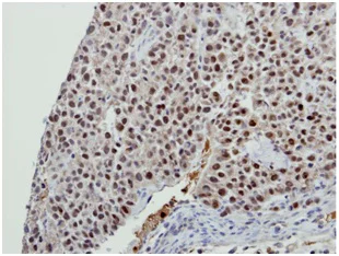 Immunohistochemistry (Formalin/PFA-fixed paraffin-embedded sections) - Anti-BCAS2 antibody (AB151293)