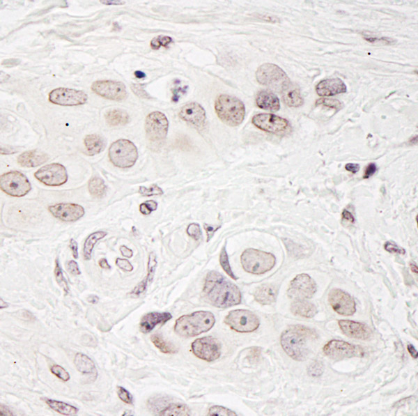 Immunohistochemistry (Formalin/PFA-fixed paraffin-embedded sections) - Anti-BCAS3 antibody (AB71162)