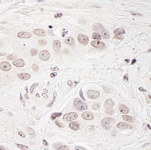 Immunohistochemistry (Formalin/PFA-fixed paraffin-embedded sections) - Anti-BCAS3 antibody (AB71162)