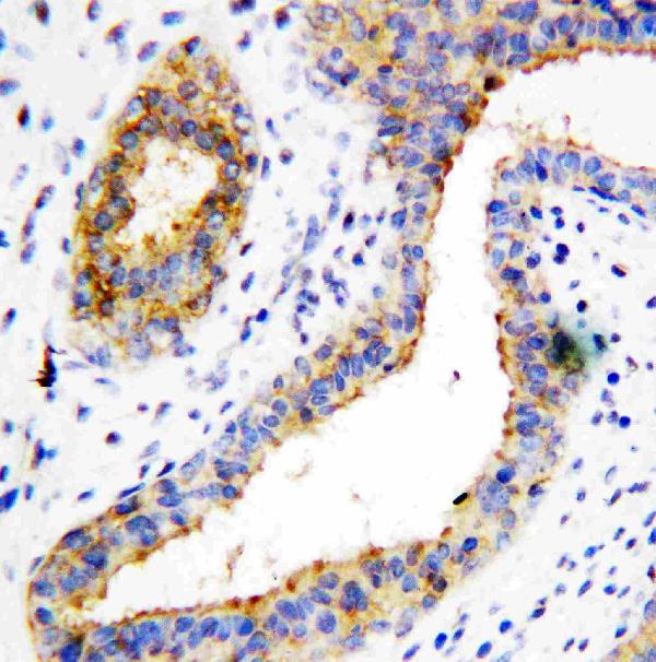 Immunohistochemistry (Formalin/PFA-fixed paraffin-embedded sections) - Anti-BCAT1 antibody (AB125209), expandable thumbnail