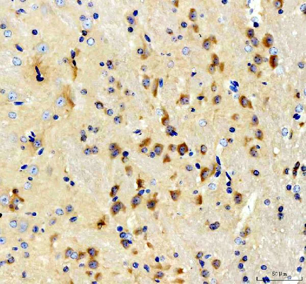 Immunohistochemistry (Formalin/PFA-fixed paraffin-embedded sections) - Anti-BCAT1 antibody (AB125209)