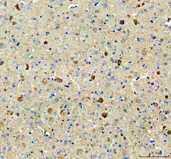 Immunohistochemistry (Formalin/PFA-fixed paraffin-embedded sections) - Anti-BCAT1 antibody (AB125209)
