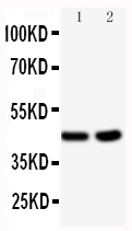 Western blot - Anti-BCAT1 antibody (AB125209), expandable thumbnail