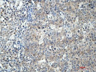 Immunohistochemistry (Formalin/PFA-fixed paraffin-embedded sections) - Anti-BCAT1 antibody (AB177096)