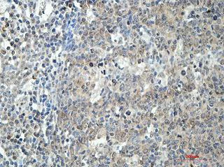 Immunohistochemistry (Formalin/PFA-fixed paraffin-embedded sections) - Anti-BCAT1 antibody (AB177096)