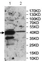 Western blot - Anti-BCAT1 antibody (AB177096)