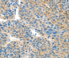 Immunohistochemistry (Formalin/PFA-fixed paraffin-embedded sections) - Anti-BCAT1 antibody (AB197941), expandable thumbnail