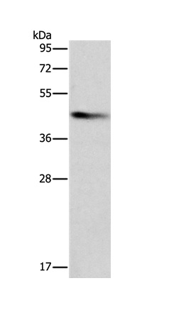 Western blot - Anti-BCAT1 antibody (AB197941), expandable thumbnail