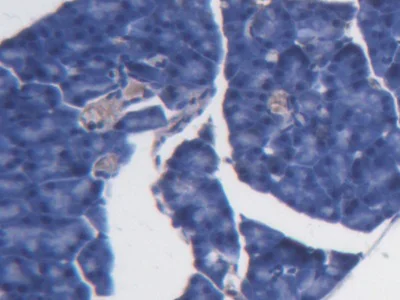 Immunohistochemistry (Formalin/PFA-fixed paraffin-embedded sections) - Anti-BCAT1 antibody (AB232700)