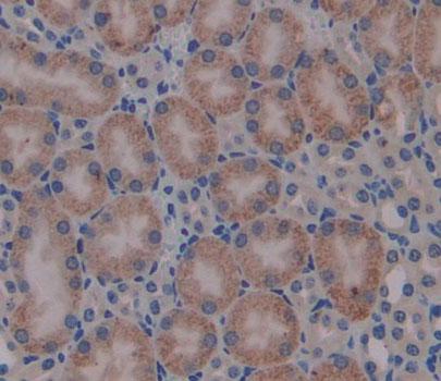 Immunohistochemistry (Formalin/PFA-fixed paraffin-embedded sections) - Anti-BCAT1 antibody (AB232700)