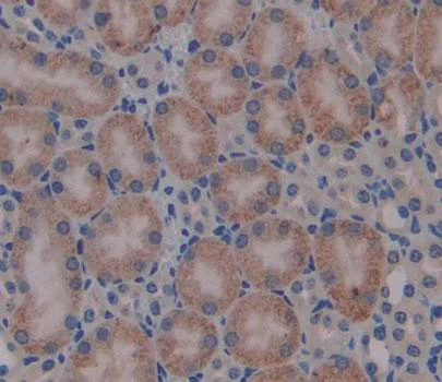 Immunohistochemistry (Formalin/PFA-fixed paraffin-embedded sections) - Anti-BCAT1 antibody (AB232700)
