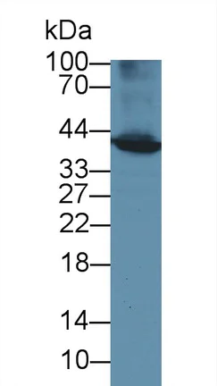 Western blot - Anti-BCAT1 antibody (AB232700)