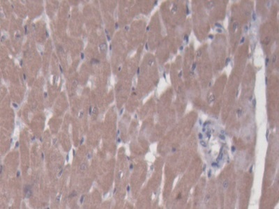 Immunohistochemistry (Formalin/PFA-fixed paraffin-embedded sections) - Anti-BCAT1 antibody (AB232706), expandable thumbnail