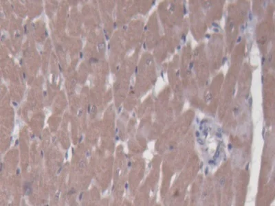 Immunohistochemistry (Formalin/PFA-fixed paraffin-embedded sections) - Anti-BCAT1 antibody (AB232706)