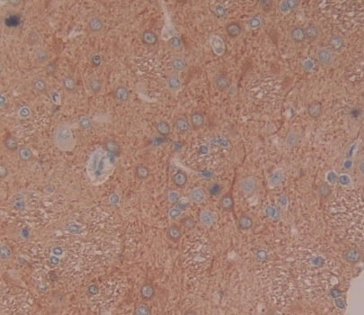 Immunohistochemistry (Formalin/PFA-fixed paraffin-embedded sections) - Anti-BCAT1 antibody (AB232706), expandable thumbnail