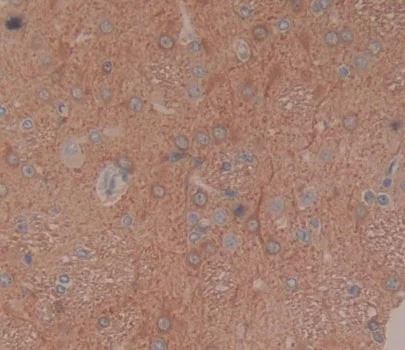 Immunohistochemistry (Formalin/PFA-fixed paraffin-embedded sections) - Anti-BCAT1 antibody (AB232706)