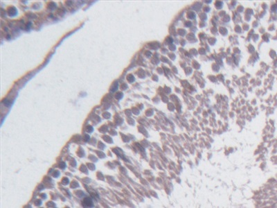 Immunohistochemistry (Formalin/PFA-fixed paraffin-embedded sections) - Anti-BCAT1 antibody (AB232706), expandable thumbnail