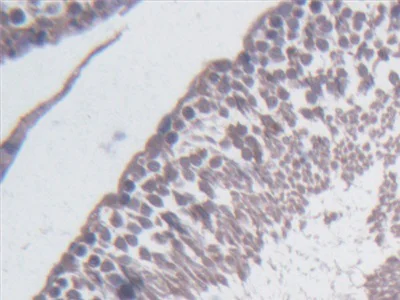 Immunohistochemistry (Formalin/PFA-fixed paraffin-embedded sections) - Anti-BCAT1 antibody (AB232706)