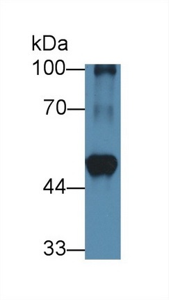 Western blot - Anti-BCAT1 antibody (ab232706), expandable thumbnail