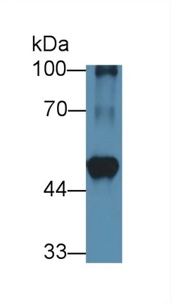 Western blot - Anti-BCAT1 antibody (AB232706)