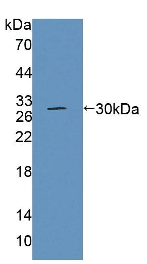 Western blot - Anti-BCAT1 antibody (AB232706)