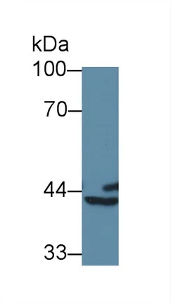 Western blot - Anti-BCAT1 antibody (AB232706)