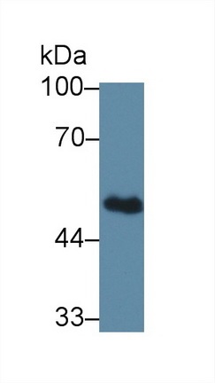 Western blot - Anti-BCAT1 antibody (AB232706), expandable thumbnail