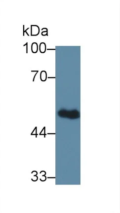 Western blot - Anti-BCAT1 antibody (AB232706)
