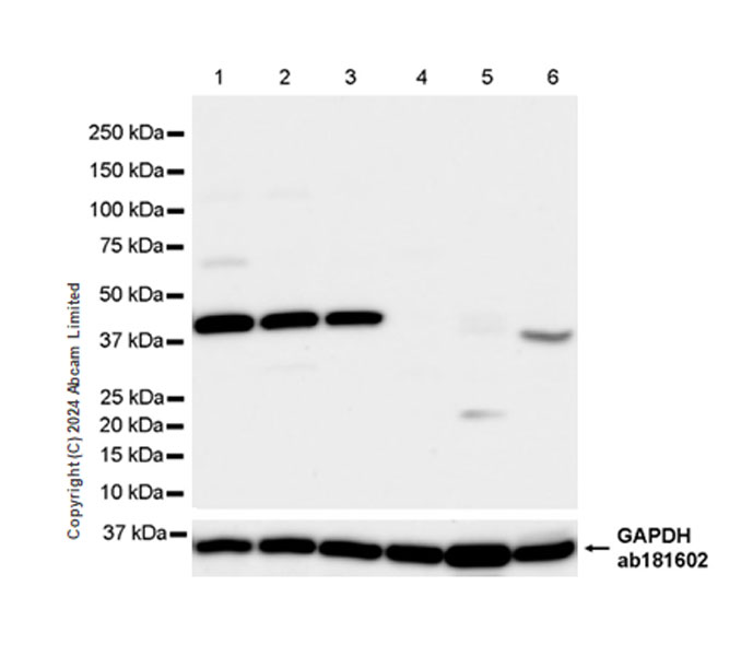 Western blot - Anti-BCAT1 antibody [EPR29208-26] - BSA and Azide free (AB320651), expandable thumbnail
