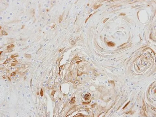 Immunohistochemistry (Formalin/PFA-fixed paraffin-embedded sections) - Anti-BCAT2 antibody (AB95976), expandable thumbnail