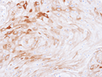 Immunohistochemistry (Formalin/PFA-fixed paraffin-embedded sections) - Anti-BCAT2 antibody (AB95976), expandable thumbnail