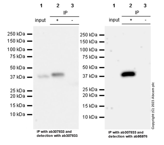 Immunoprecipitation - Anti-BCAT2 antibody (AB95976), expandable thumbnail