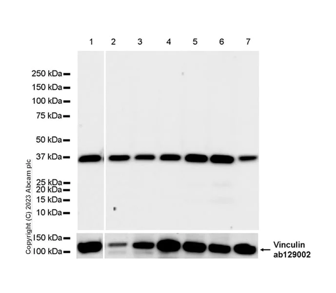 Western blot - Anti-BCAT2 antibody [EPR27488-72] - BSA and Azide free (AB307834)