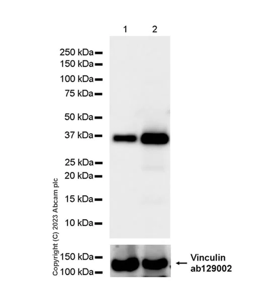 Western blot - Anti-BCAT2 antibody [EPR27488-72] - BSA and Azide free (AB307834)