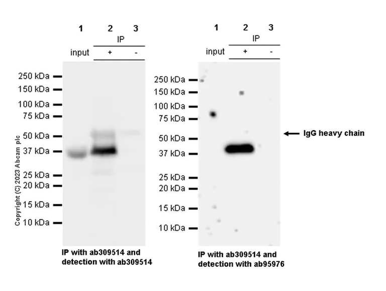 Immunoprecipitation - Anti-BCAT2 antibody [EPR27488-91] (AB309514)