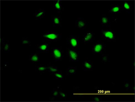 Immunocytochemistry/ Immunofluorescence - Anti-BCCIP antibody (AB168157)