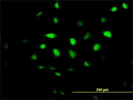 Immunocytochemistry/ Immunofluorescence - Anti-BCCIP antibody (AB168157)