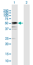 Western blot - Anti-BCCIP antibody (AB168157)