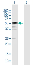 Western blot - Anti-BCCIP antibody (AB168157)